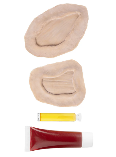 Wunde "Fleischwunde"