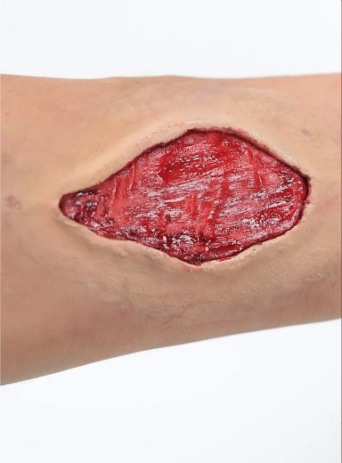 Wunde "Fleischwunde"