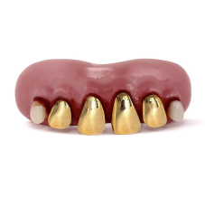 Zähne "Golden Gums"